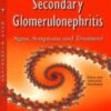 Primary and secondary glomerulonephritis signs symptoms and treatment 197x3001 1 176x268 1.jpg