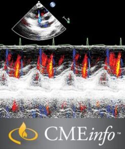 Echocardiography – A Comprehensive Review 2020