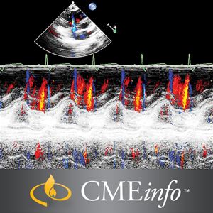 Echocardiography – A Comprehensive Review 2020