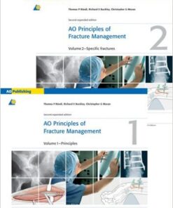 Ebook AO Principles of Fracture Management – 2 Volume  – 2nd Edition
