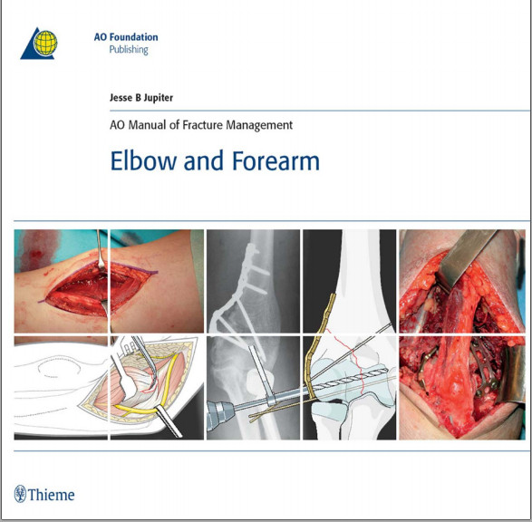 AO Manual of Fracture Management: Elbow & Forearm: Elbow & Forearm AO Manual of Fracture Management: Elbow & Forearm: Elbow & Forearm