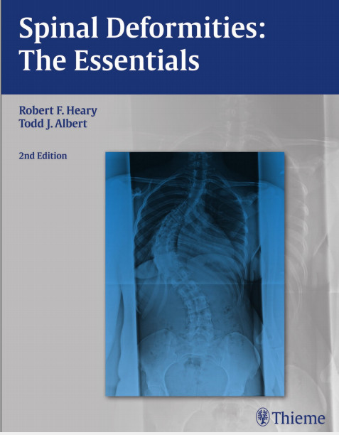 Spinal Deformities: The Essentials 2nd edition Edition Spinal Deformities: The Essentials 2nd edition Edition