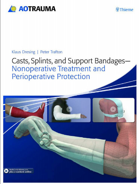 Casts, Splints, and Support Bandages: Nonoperative Treatment and Perioperative Protection 1st Edition Casts, Splints, and Support Bandages: Nonoperative Treatment and Perioperative Protection 1st Edition