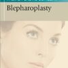 Thomas Procedures in Facial Plastic Surgery : Blepharoplasty Thomas Procedures in Facial Plastic Surgery : Blepharoplasty