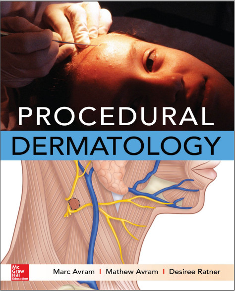 Procedural Dermatology 1st Edition Procedural Dermatology 1st Edition