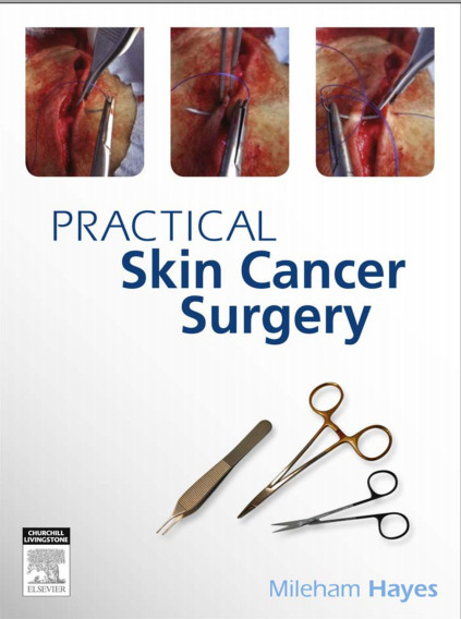 Practical Skin Cancer Surgery Practical Skin Cancer Surgery