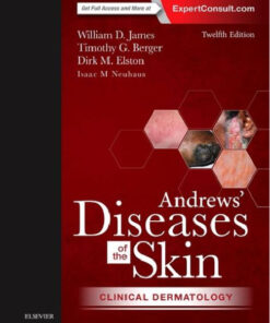Andrews’ Diseases of the Skin: Clinical Dermatology, 12e