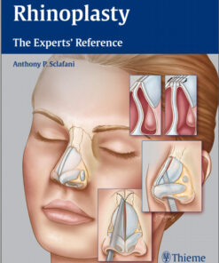 Rhinoplasty: The Experts’ Reference 1st Edition