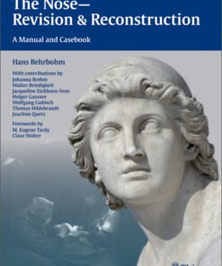 The Nose – Revision and Reconstruction: A Manual and Casebook 1st edition