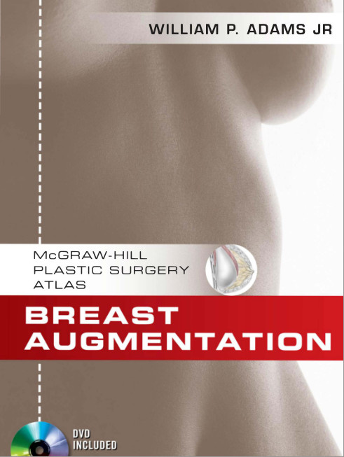 Breast Augmentation (McGraw-Hill Plastic Surgery Atlas) 1st Edition Breast Augmentation (McGraw-Hill Plastic Surgery Atlas) 1st Edition