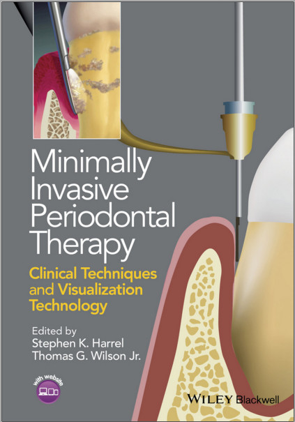 Ebook Minimally Invasive Periodontal Therapy: Clinical Techniques and Visualization Technology 1st Edition