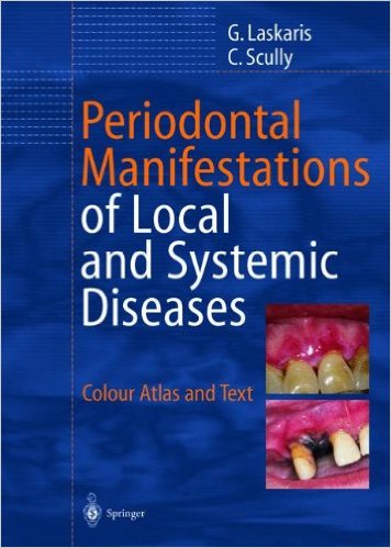 Ebook Periodontal Manifestations of Local and Systemic Diseases: Colour Atlas and Text