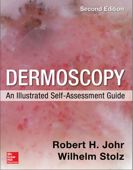 Dermoscopy: An Illustrated Self-Assessment Guide 2nd Edition Dermoscopy: An Illustrated Self-Assessment Guide 2nd Edition