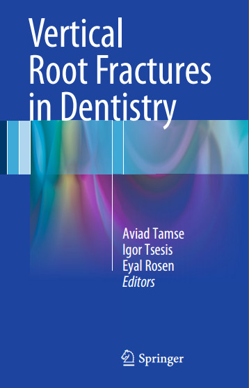 Ebook Vertical Root Fractures in Dentistry 2015th Edition Ebook Vertical Root Fractures in Dentistry 2015th Edition