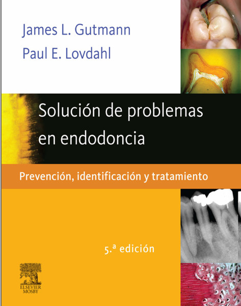 Ebook Solución de problemas en endodoncia: Prevención, identificación y tratamient