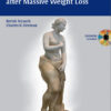 Encyclopedia of Body Sculpting After Massive Weight Loss 1st Edition Encyclopedia of Body Sculpting After Massive Weight Loss 1st Edition