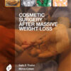 Cosmetic Surgery After Massive Weight Loss 1st Edition Cosmetic Surgery After Massive Weight Loss 1st Edition