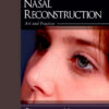 Nasal Reconstruction: Art and Practice, 1e Nasal Reconstruction: Art and Practice, 1e
