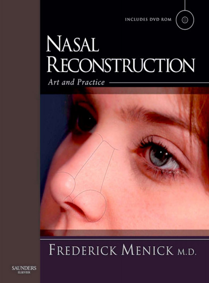 Nasal Reconstruction: Art and Practice, 1e Nasal Reconstruction: Art and Practice, 1e
