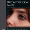 Reconstrucción nasal: Arte y práctica (Spanish Edition) Reconstrucción nasal: Arte y práctica (Spanish Edition)
