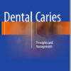 Ebook Dental Caries: Principles and Management 1st ed. 2016 Edition Ebook Dental Caries: Principles and Management 1st ed. 2016 Edition