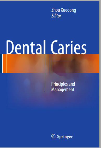 Ebook Dental Caries: Principles and Management 1st ed. 2016 Edition Ebook Dental Caries: Principles and Management 1st ed. 2016 Edition