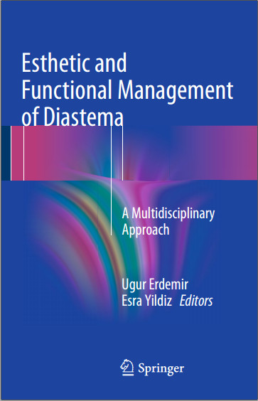 Ebook Esthetic and Functional Management of Diastema: A Multidisciplinary Approach 1st ed. 2016 Edition