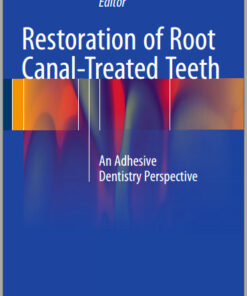 Restoration of Root Canal-Treated Teeth: An Adhesive Dentistry Perspective 1st ed. 2016 Edition