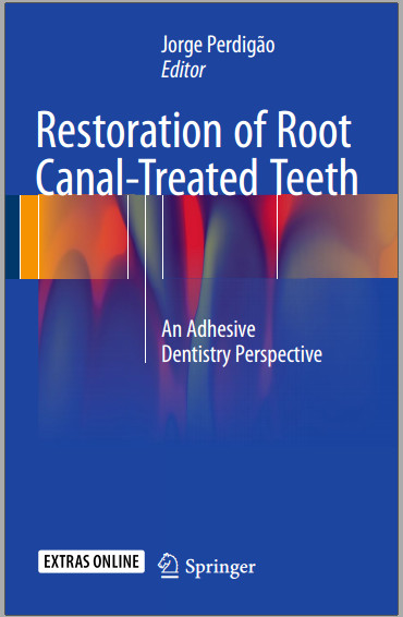Restoration of Root Canal-Treated Teeth: An Adhesive Dentistry Perspective 1st ed. 2016 Edition
