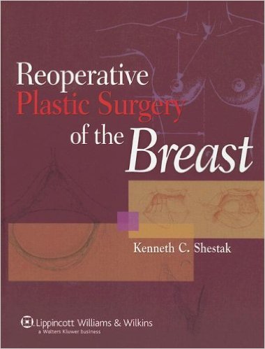 Reoperative Plastic Surgery of the Breast 1st Edition Reoperative Plastic Surgery of the Breast 1st Edition