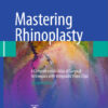 Mastering Rhinoplasty: A Comprehensive Atlas of Surgical Techniques with Integrated Video Clips 2nd ed Mastering Rhinoplasty: A Comprehensive Atlas of Surgical Techniques with Integrated Video Clips 2nd ed