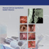 Transoral Laser Microsurgery of Benign and Malignant Lesions 1st edition Transoral Laser Microsurgery of Benign and Malignant Lesions 1st edition