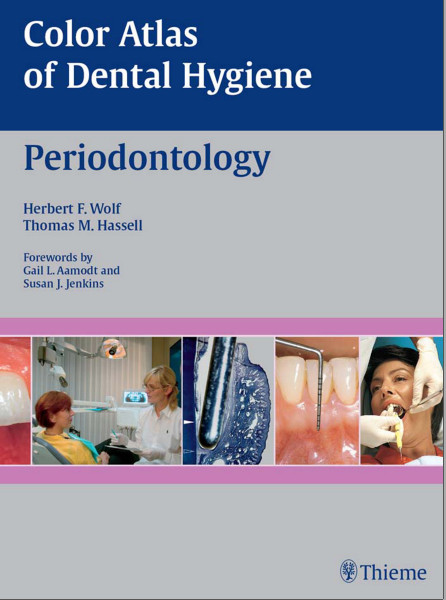 Color Atlas of Dental Hygiene: Periodontology