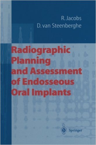 Radiographic Planning and Assessment of Endosseous Oral Implants