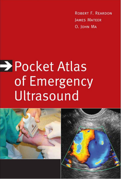 Pocket Atlas of Emergency Ultrasound (Atlas Series) 1st Edition Pocket Atlas of Emergency Ultrasound (Atlas Series) 1st Edition