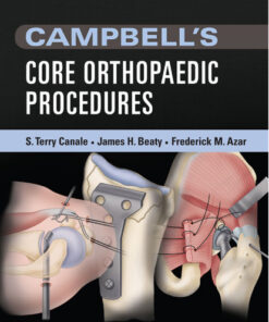 Campbell’s Core Orthopaedic Procedures, 1e