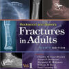 Rockwood and Green’s Fractures in Adults (2 Volume Set) Eighth, In two volumes Edition Rockwood and Green’s Fractures in Adults (2 Volume Set) Eighth, In two volumes Edition