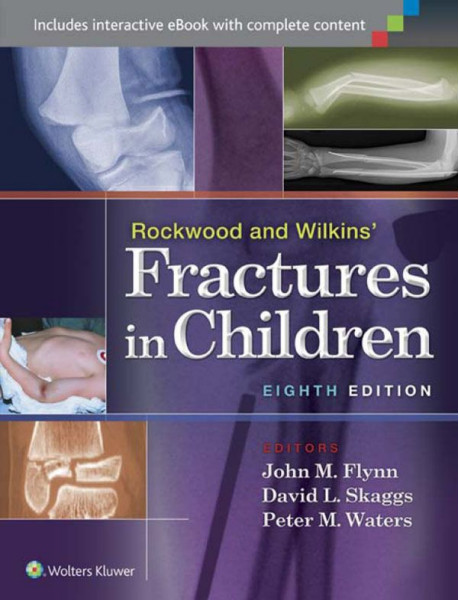 Rockwood and Wilkins’ Fractures in Children Eighth Edition Rockwood and Wilkins’ Fractures in Children Eighth Edition