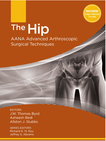 The Hip: AANA Advanced Arthroscopic Surgical Techniques The Hip: AANA Advanced Arthroscopic Surgical Techniques