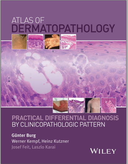 An Atlas of Dermoscopy, Second Edition 2nd Edition An Atlas of Dermoscopy, Second Edition 2nd Edition