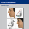 DVD Videos + Ebooks Rhinoplasty – Cases and Techniques 1st edition