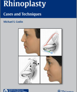 DVD Videos + Ebooks Rhinoplasty – Cases and Techniques 1st edition