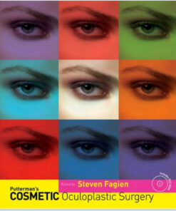 Putterman’s Cosmetic Oculoplastic Surgery