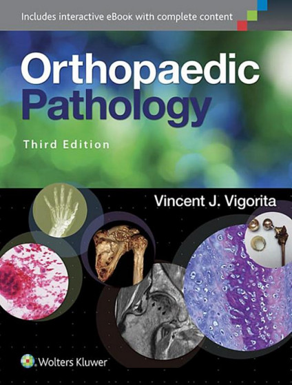 Orthopaedic Pathology Third Edition Orthopaedic Pathology Third Edition