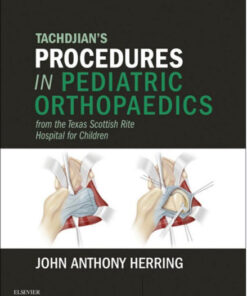 Tachdjian’s Procedures in Pediatric Orthopaedics: From the Texas Scottish Rite Hospital for Children, 1e