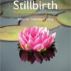 Stillbirth: Prediction, Prevention and Management 1st Edition Stillbirth: Prediction, Prevention and Management 1st Edition