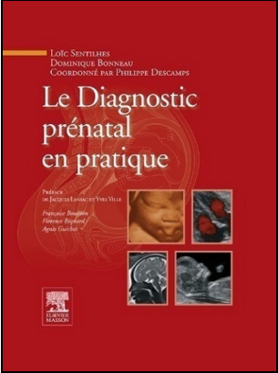 Le Diagnostic prénatal en pratique (French Edition) Le Diagnostic prénatal en pratique (French Edition)