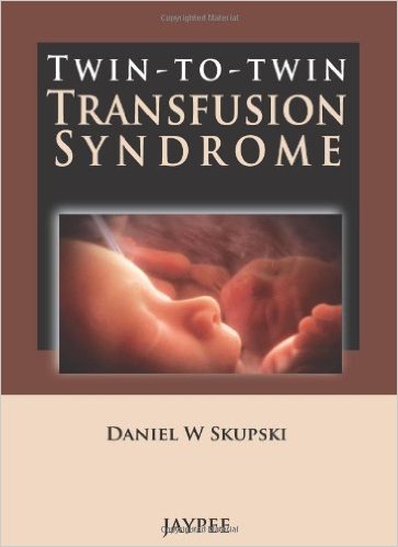 Twin-to-Twin Transfusion Syndrome 1st Edition Twin-to-Twin Transfusion Syndrome 1st Edition