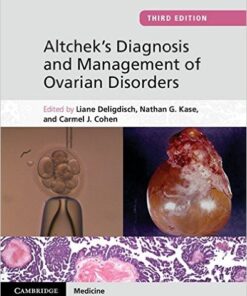 Altchek’s Diagnosis and Management of Ovarian Disorders 3rd Edition