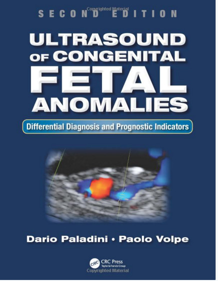 Ultrasound of Congenital Fetal Anomalies: Differential Diagnosis and Prognostic Indicators, Second Edition 2nd Edition Ultrasound of Congenital Fetal Anomalies: Differential Diagnosis and Prognostic Indicators, Second Edition 2nd Edition